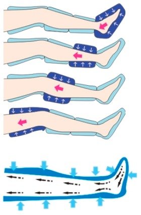 efeito de onda pressoterapia 1