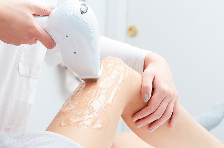 Depilação a Laser Díodo Pernas