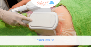 criolipolise banner artigo