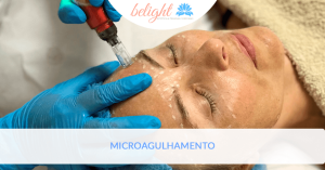 Microagulhamento blog