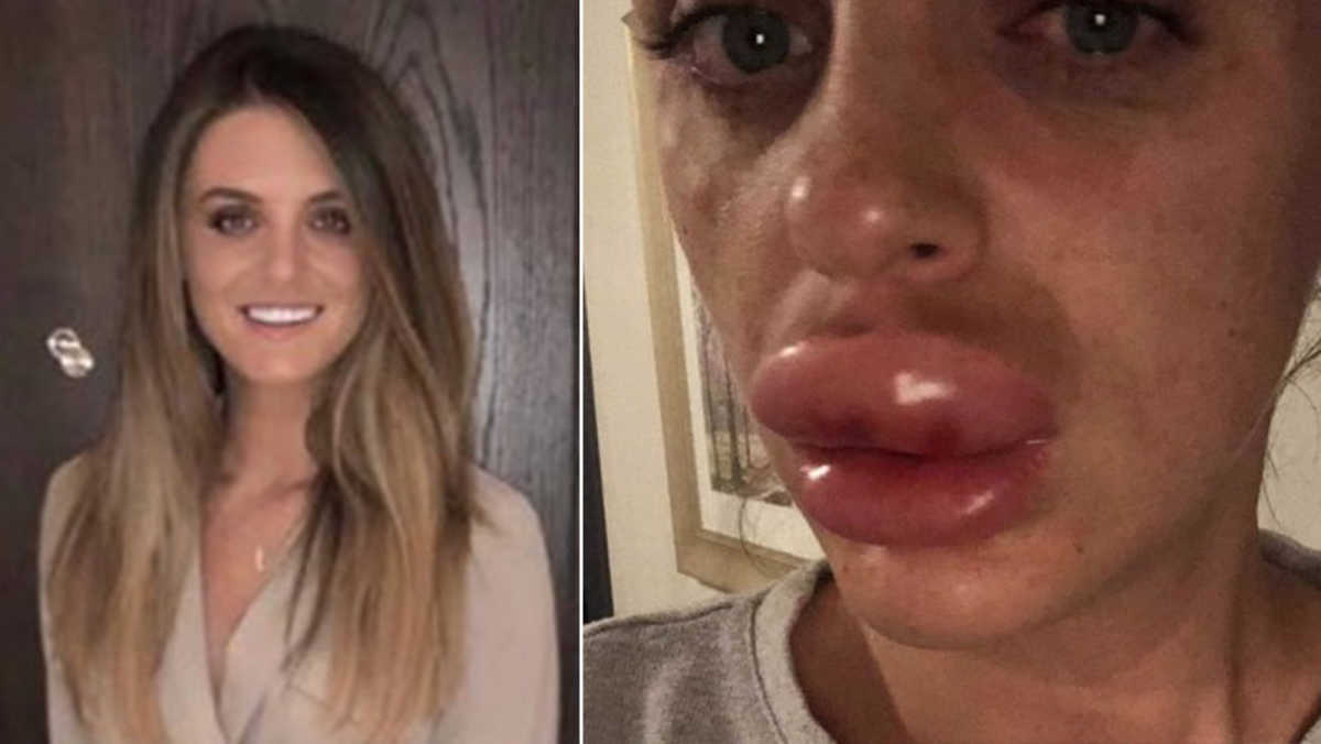 featured img of post rv 14205