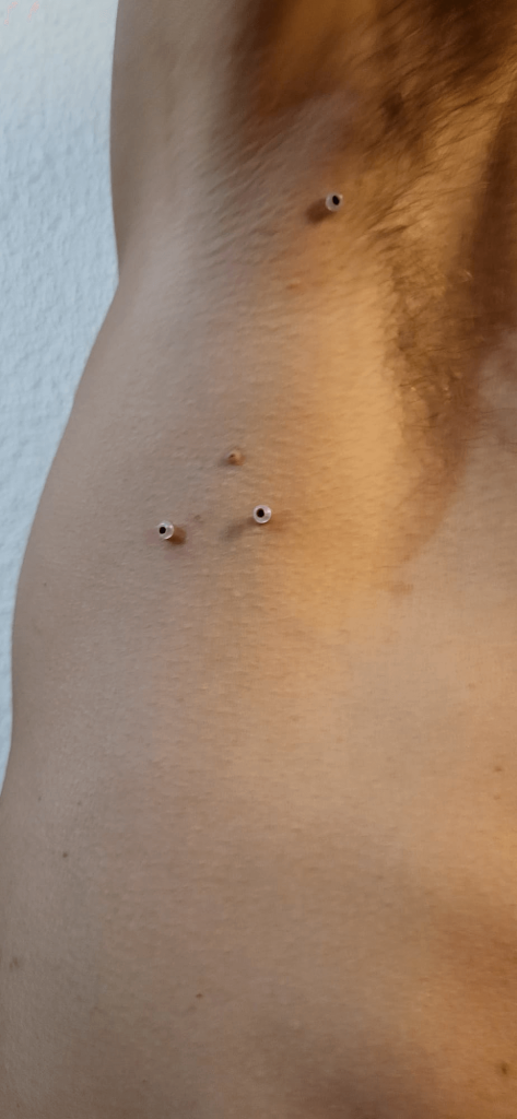 Tirar sinais tratamento caseiro