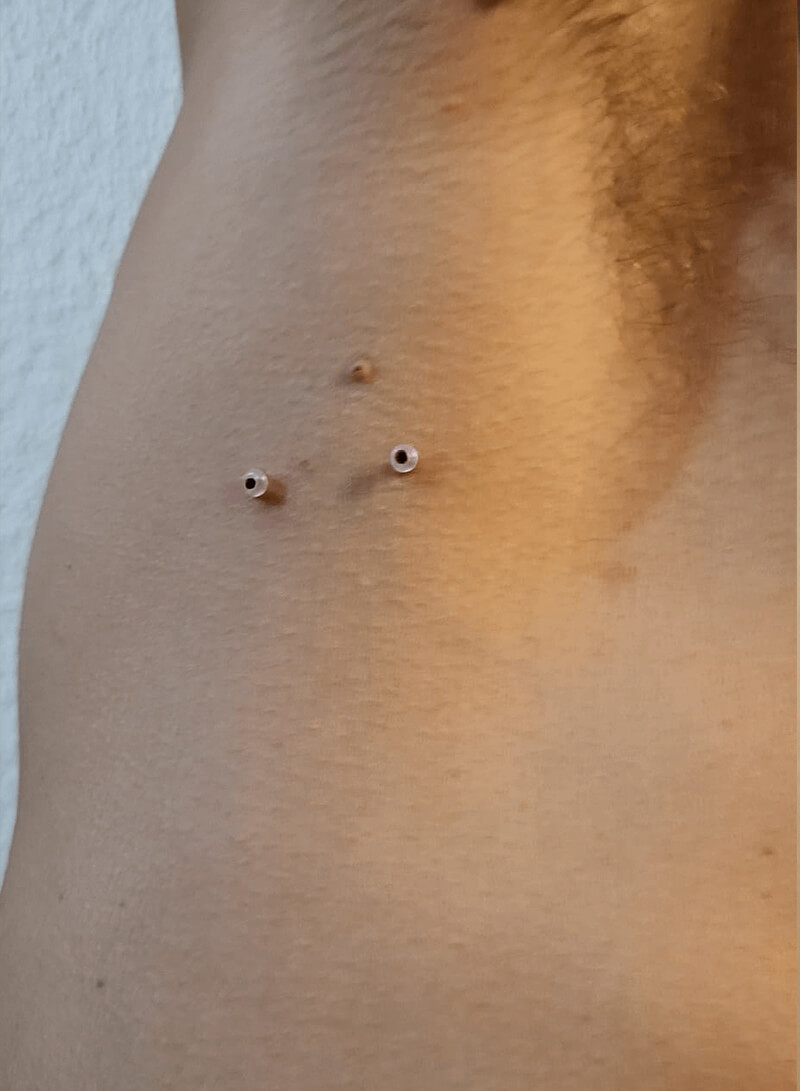 Tirar Sinais Jato de Plasma