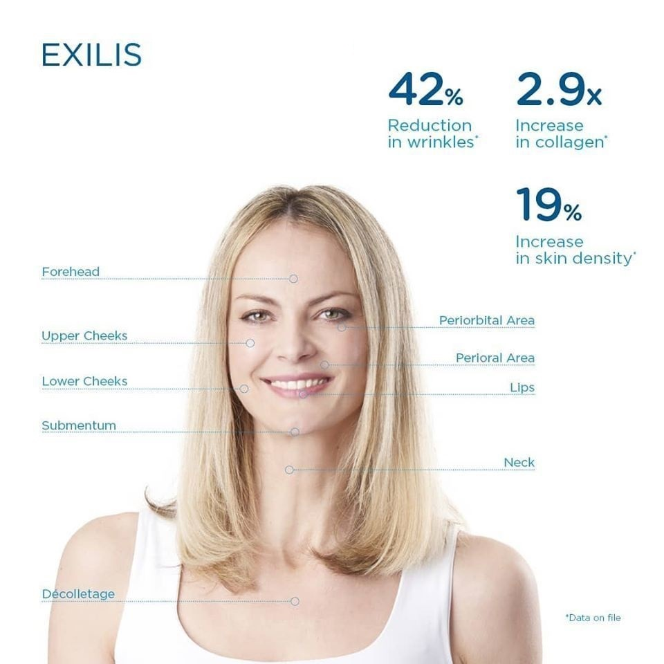 Exilis rosto