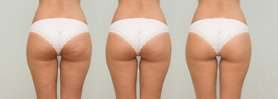 X Wave Ondas Acusticas 9