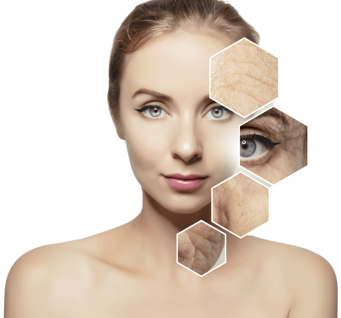 zonas de aplicacao de toxina botulinica 1