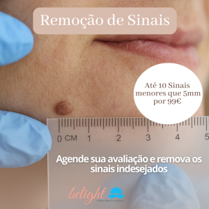 Para Remoção de Sinais/Verrugas agenda uma avaliação em nossa Clínica.