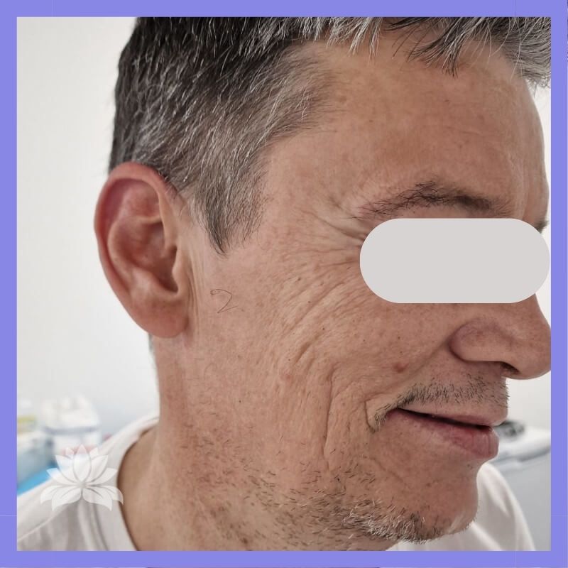 caso antes e depois 547-8