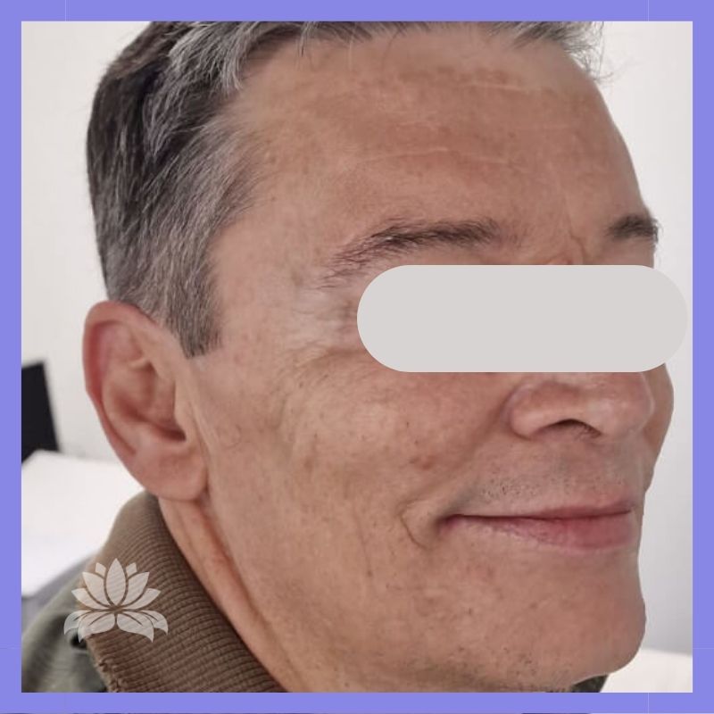 caso antes e depois 547-7