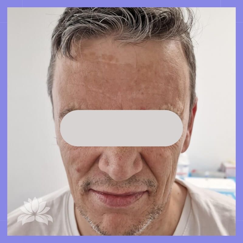 caso antes e depois 547-3