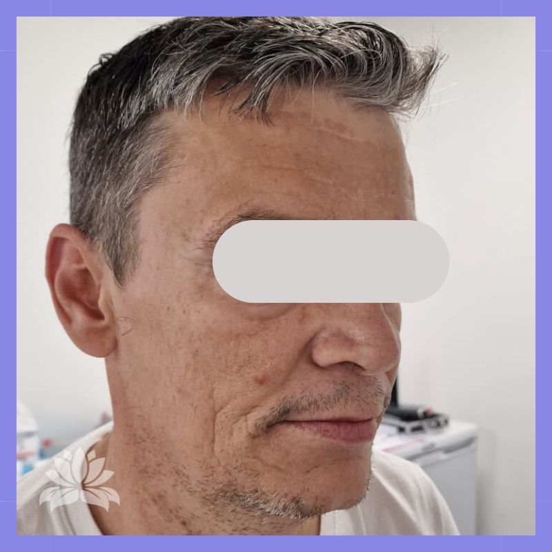 caso antes e depois 547-1