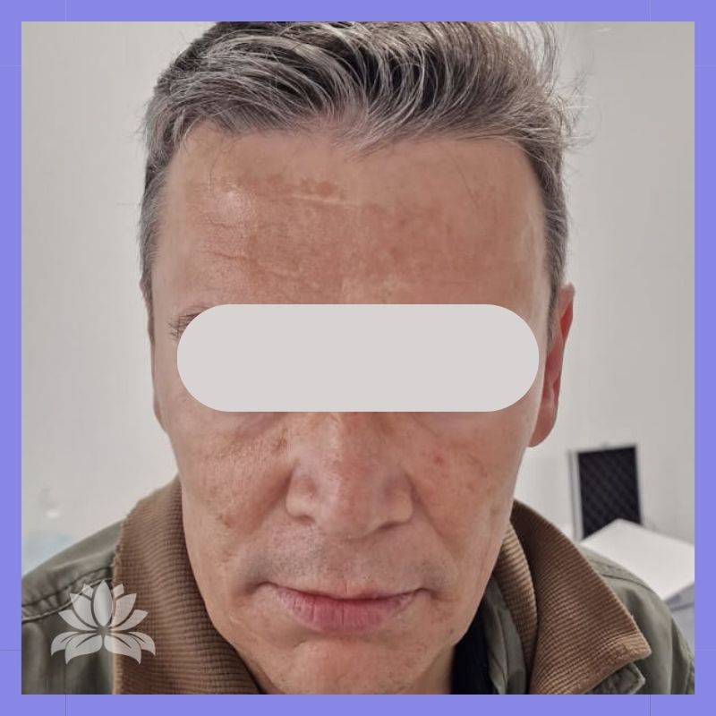 caso antes e depois 547-4