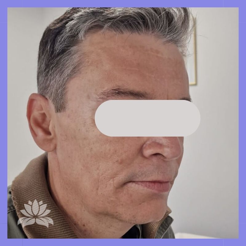 caso antes e depois 547-2