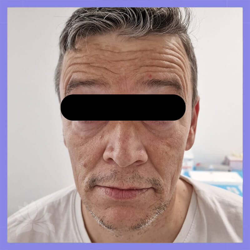 caso antes e depois 547-9