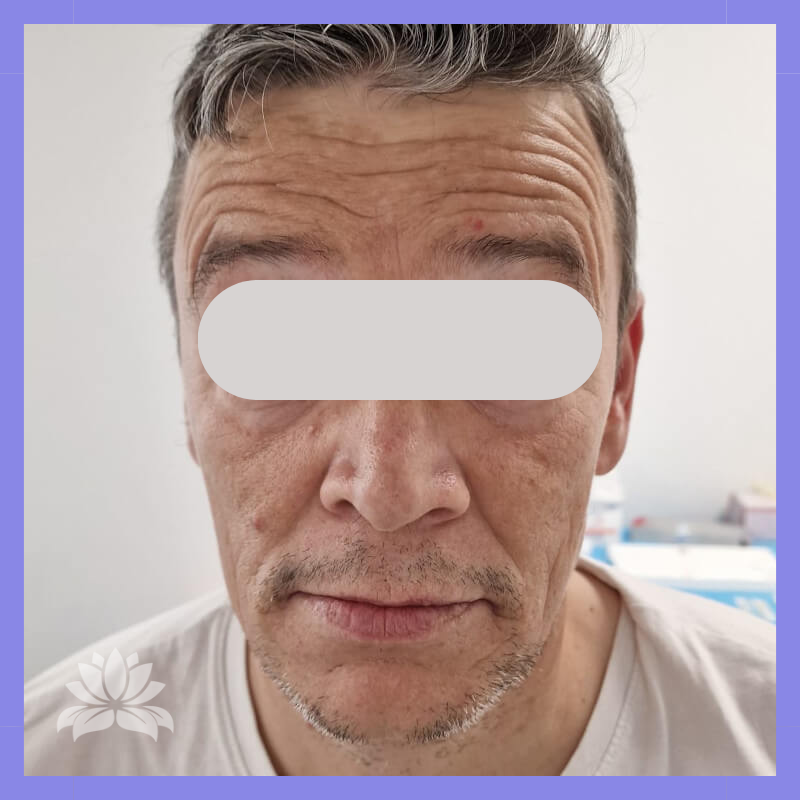 caso antes e depois 547-6