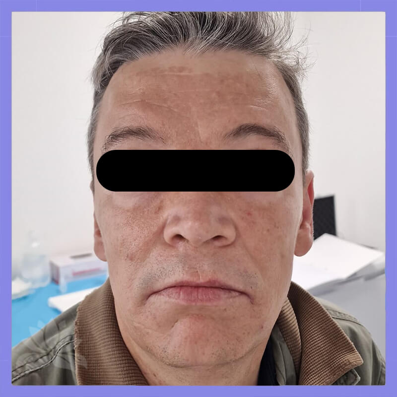 caso antes e depois 547-10