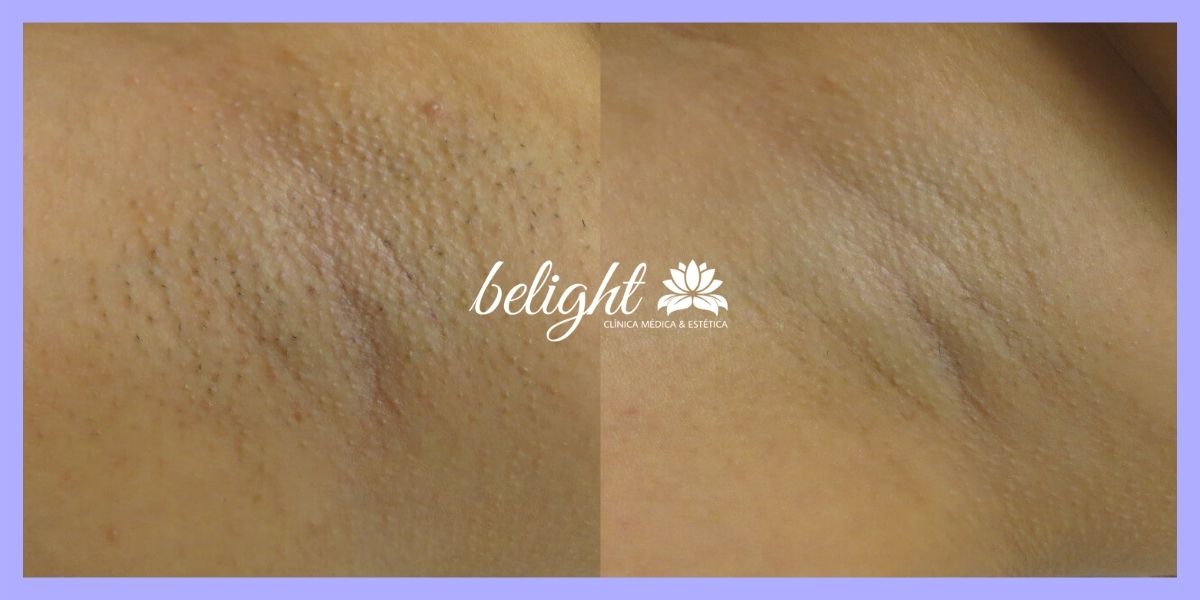 caso 908 antes e depois banner