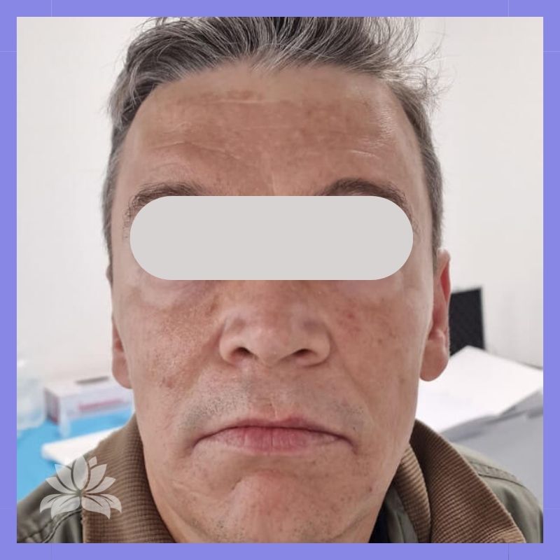 caso antes e depois 547-5