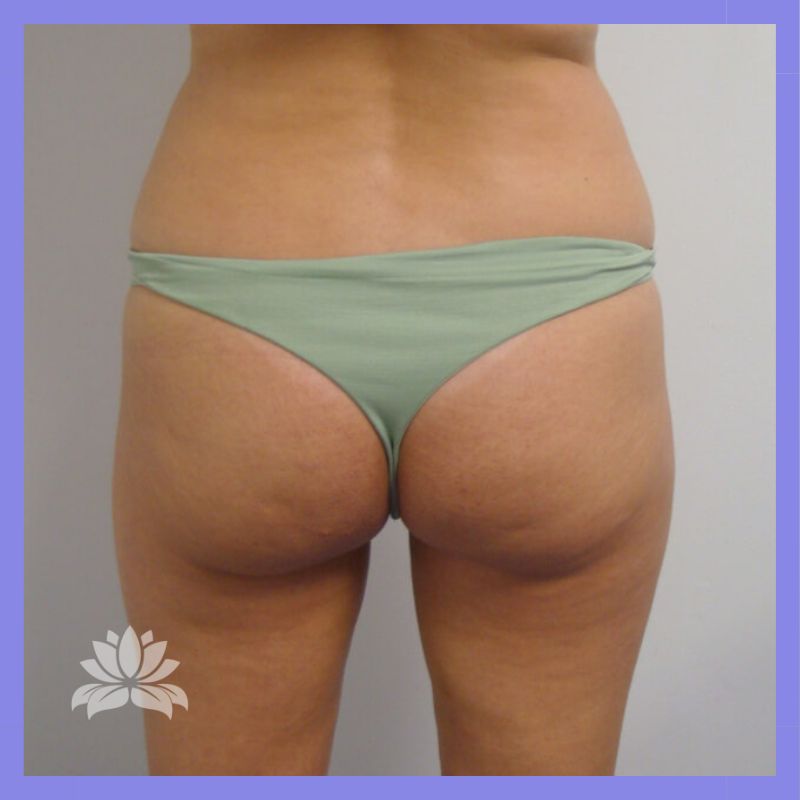 Caso 376 antes e depois 13