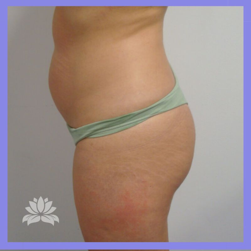 caso 376 antes e depois 2.1.0.