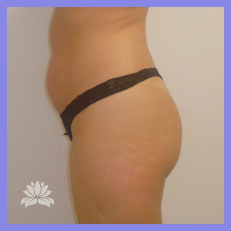 caso 376 antes e depois 2.1.1.