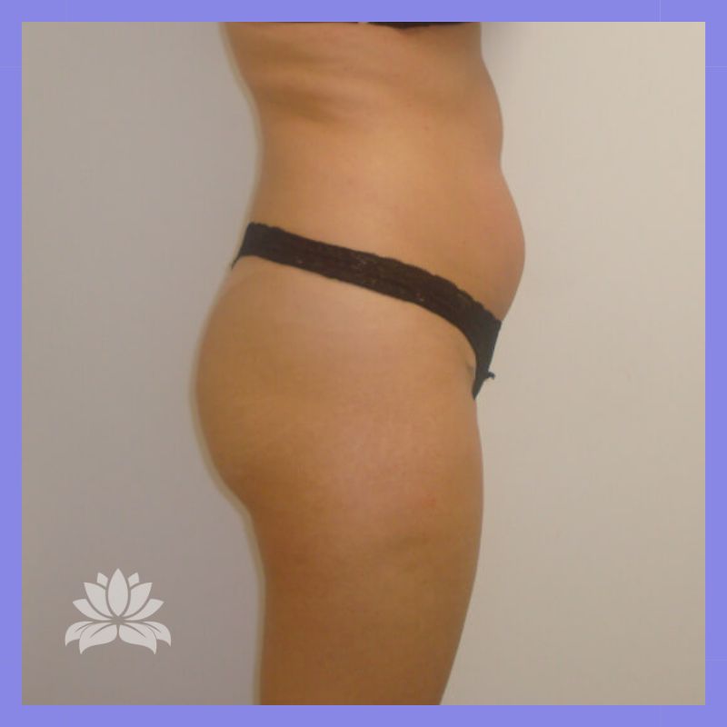 caso 376 antes e depois 4.1