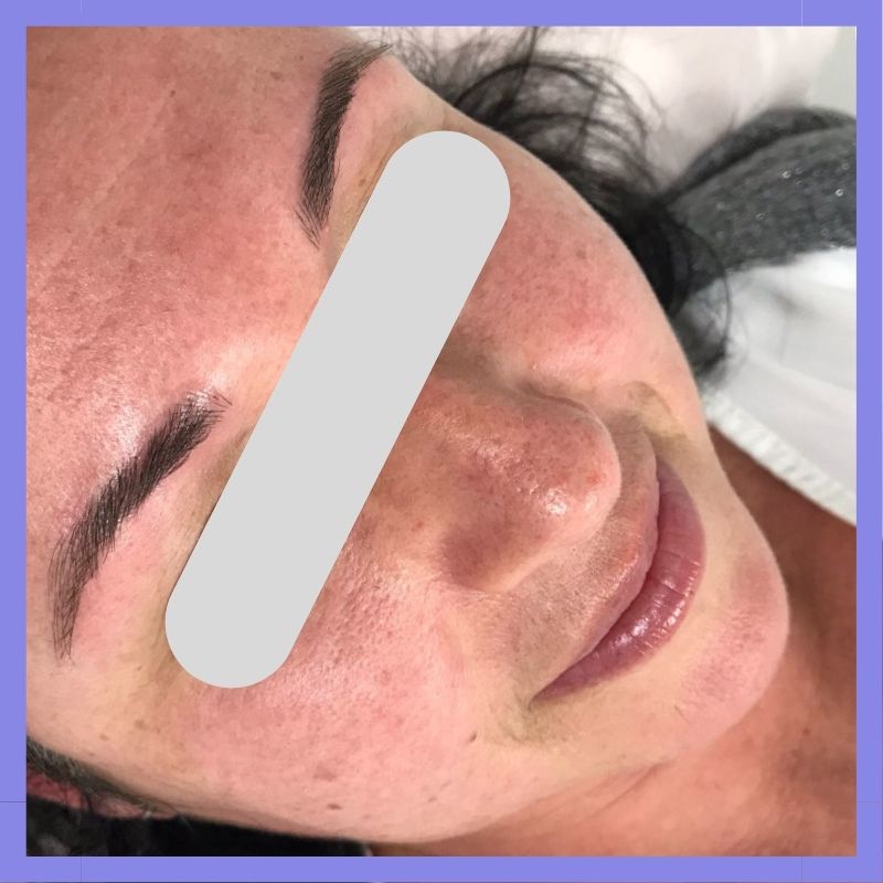 caso 285 02 03 microblading