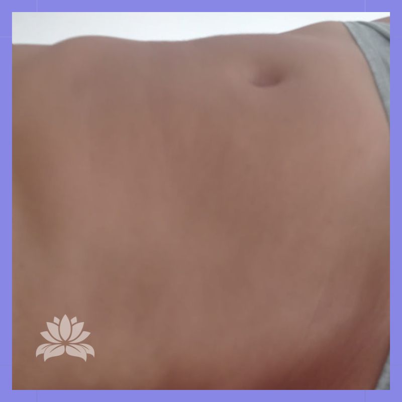 caso Abdomen antes dlm