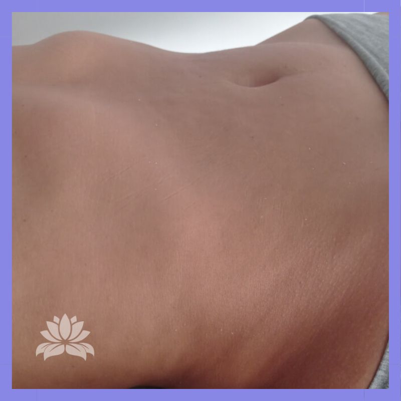 caso abdomen depois dlm