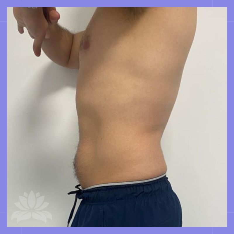 499 caso antes e depois 3.1