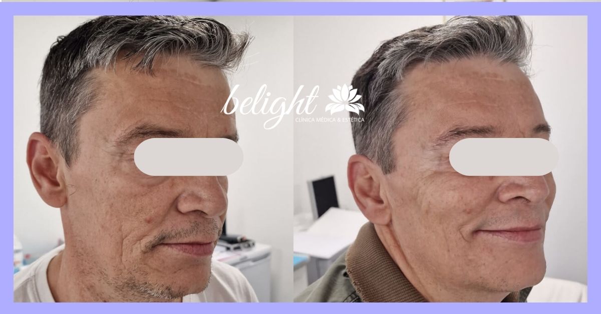 Caso 547 toxina bot banner