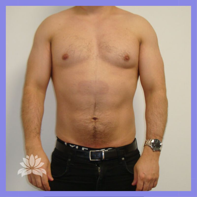 caso 499 antes e depois 1 2