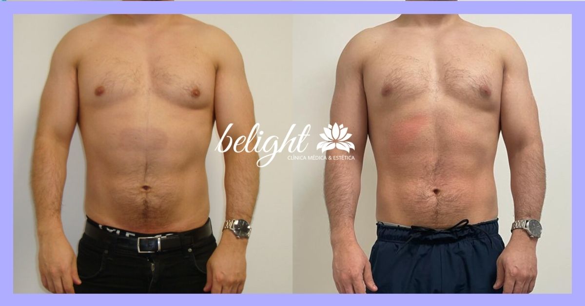 banner 499 caso antes e depois