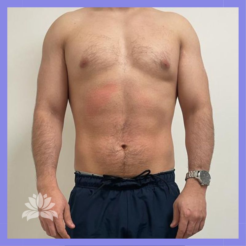 caso 499 antes e depois 202