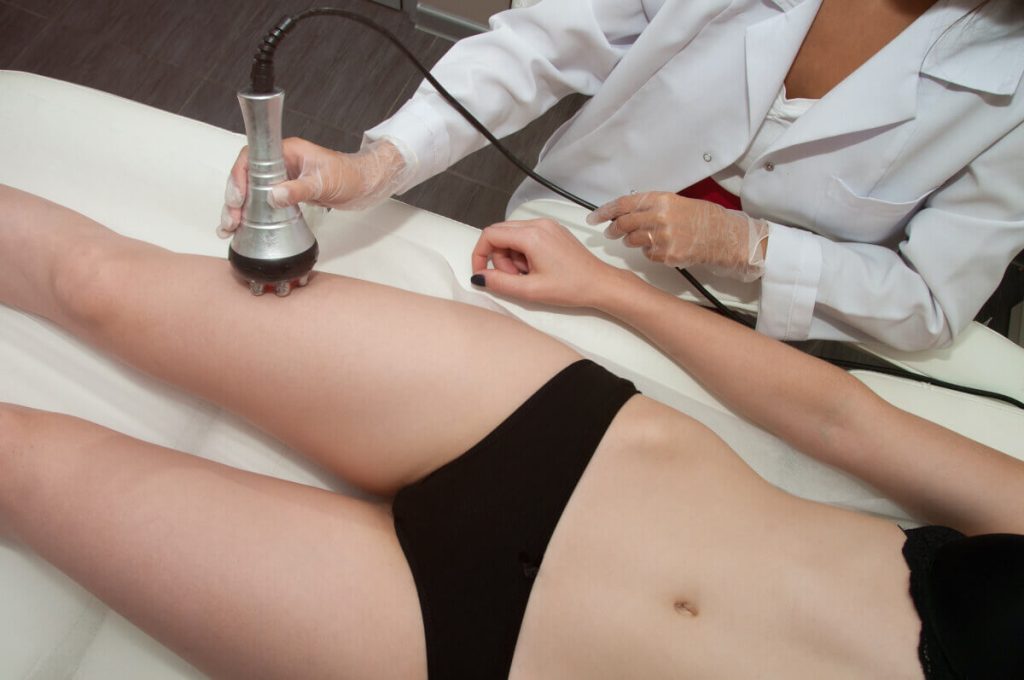 radiofrequencia corpo belight 3