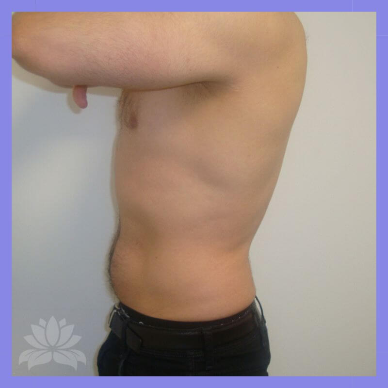 499 caso antes e depois 3