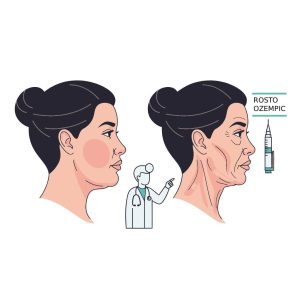 Rosto Ozempic